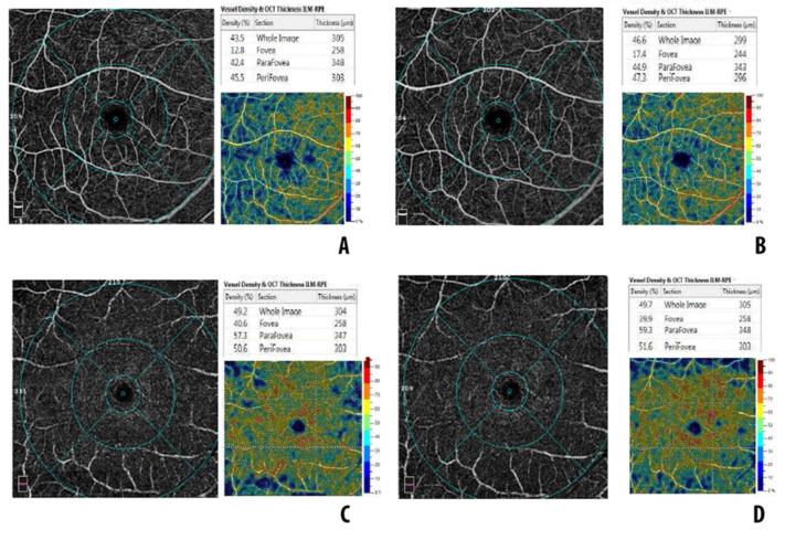 https://cdn.ncbi.nlm.nih.gov/pmc/blobs/a943/9776469/aa51ad7d3c3b/diagnostics-12-03015-g001.jpg