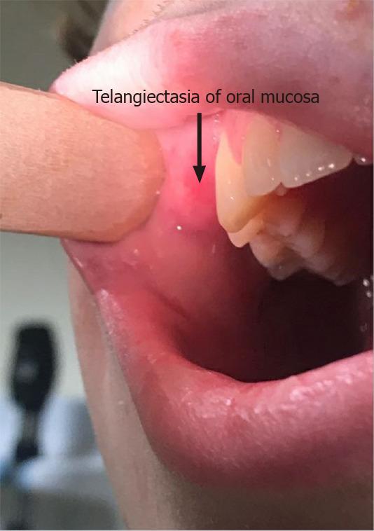 https://cdn.ncbi.nlm.nih.gov/pmc/blobs/a94a/7809591/21e974374919/WJCP-10-1-g001.jpg