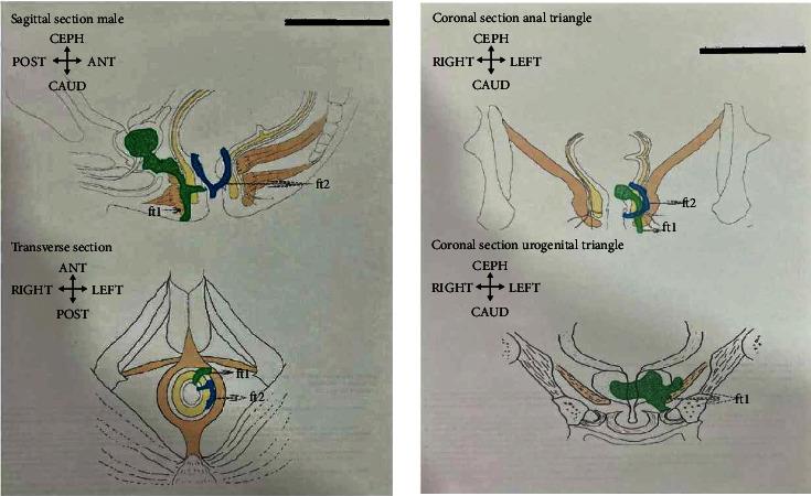 https://cdn.ncbi.nlm.nih.gov/pmc/blobs/a94c/11479797/cd737345aa6c/CRIS2024-6019946.001.jpg