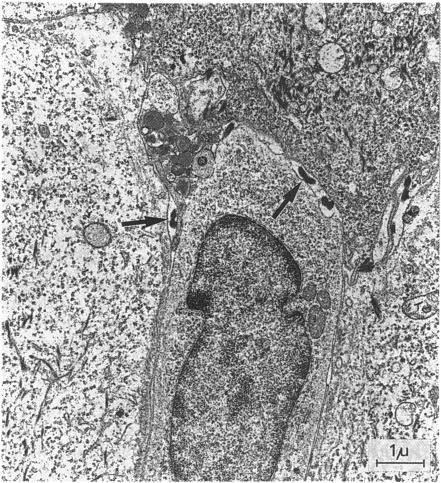 https://cdn.ncbi.nlm.nih.gov/pmc/blobs/a951/1194741/3727478999ac/genitmed00041-0048-a.jpg