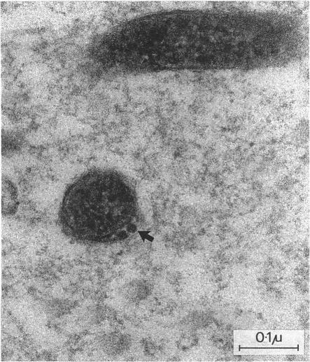 https://cdn.ncbi.nlm.nih.gov/pmc/blobs/a951/1194741/ceded834cfa5/genitmed00041-0050-b.jpg
