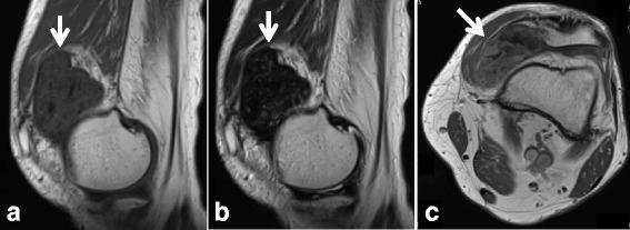 https://cdn.ncbi.nlm.nih.gov/pmc/blobs/a958/5577790/8046d43c8cbe/12891_2017_1736_Fig5_HTML.jpg