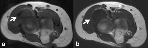https://cdn.ncbi.nlm.nih.gov/pmc/blobs/a958/5577790/d3680dbe000b/12891_2017_1736_Fig1_HTML.jpg