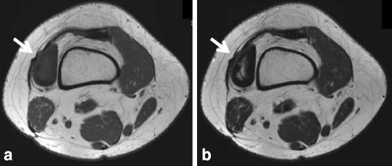 https://cdn.ncbi.nlm.nih.gov/pmc/blobs/a958/5577790/e200a4c6e7eb/12891_2017_1736_Fig3_HTML.jpg