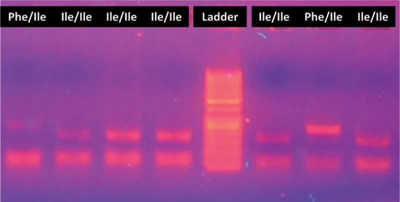 https://cdn.ncbi.nlm.nih.gov/pmc/blobs/a95b/5604643/e1865e28cf19/medi-96-e7933-g003.jpg