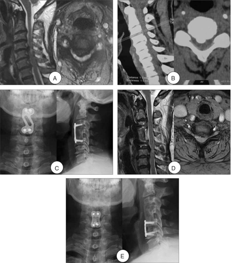 https://cdn.ncbi.nlm.nih.gov/pmc/blobs/a962/5466215/395a4d71a782/medi-96-e7042-g002.jpg