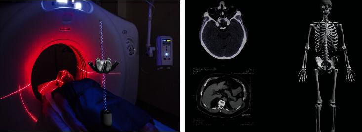 https://cdn.ncbi.nlm.nih.gov/pmc/blobs/a964/8096576/bb04a2e15167/JHE2021-5522492.004.jpg