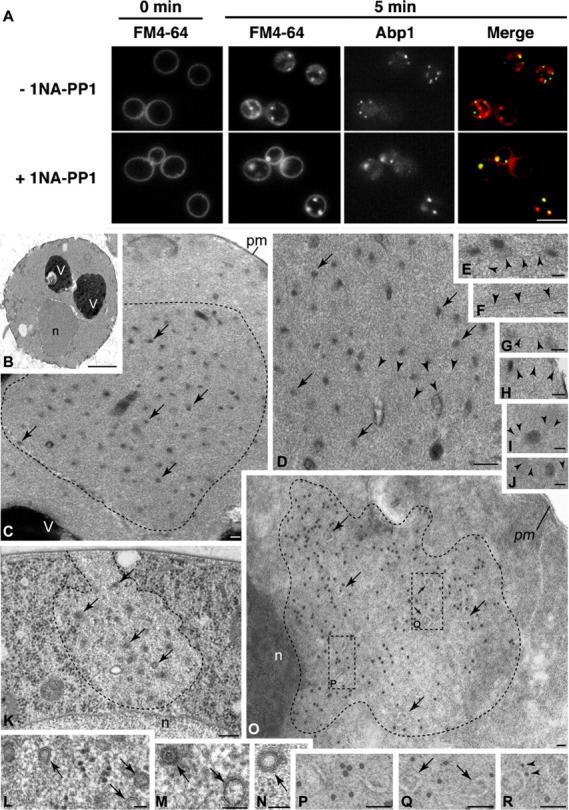 https://cdn.ncbi.nlm.nih.gov/pmc/blobs/a966/2172809/8c4296998533/200305077f4.jpg
