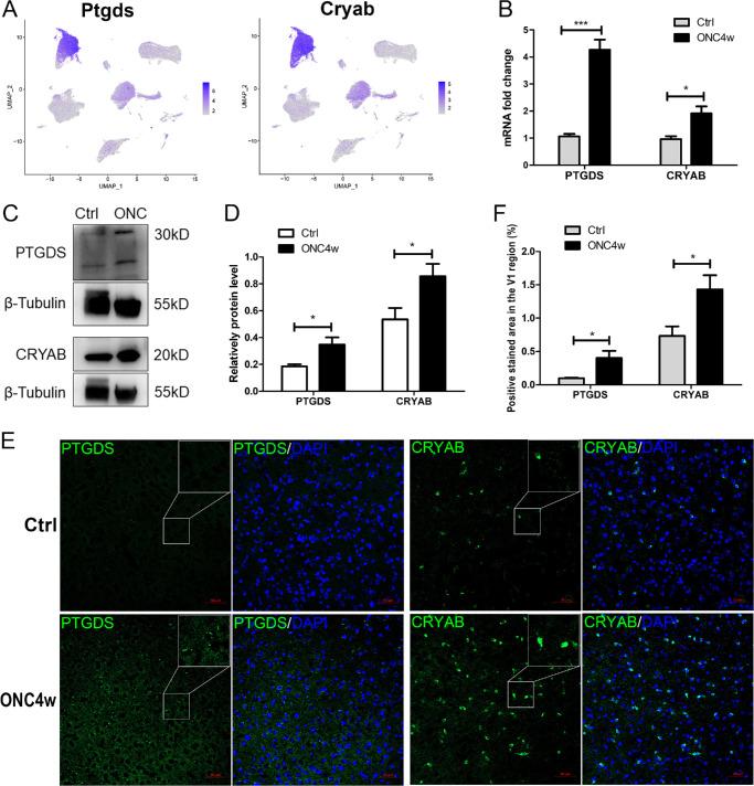 https://cdn.ncbi.nlm.nih.gov/pmc/blobs/a969/12118511/60849755df57/iovs-66-5-31-f004.jpg