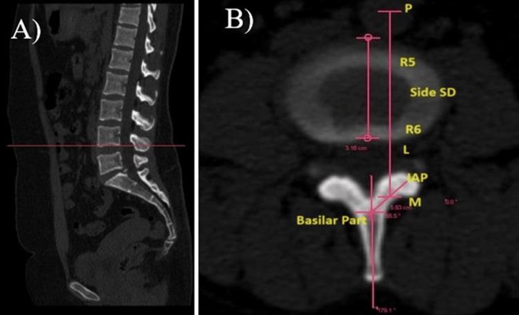 https://cdn.ncbi.nlm.nih.gov/pmc/blobs/a96c/11357736/1939edc297c4/cureus-0016-00000065631-i04.jpg