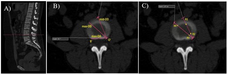 https://cdn.ncbi.nlm.nih.gov/pmc/blobs/a96c/11357736/289b9a481f5c/cureus-0016-00000065631-i02.jpg