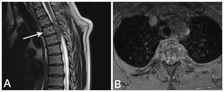 https://cdn.ncbi.nlm.nih.gov/pmc/blobs/a96d/11568418/be48b02f3c33/cureus-0016-00000071676-i01.jpg