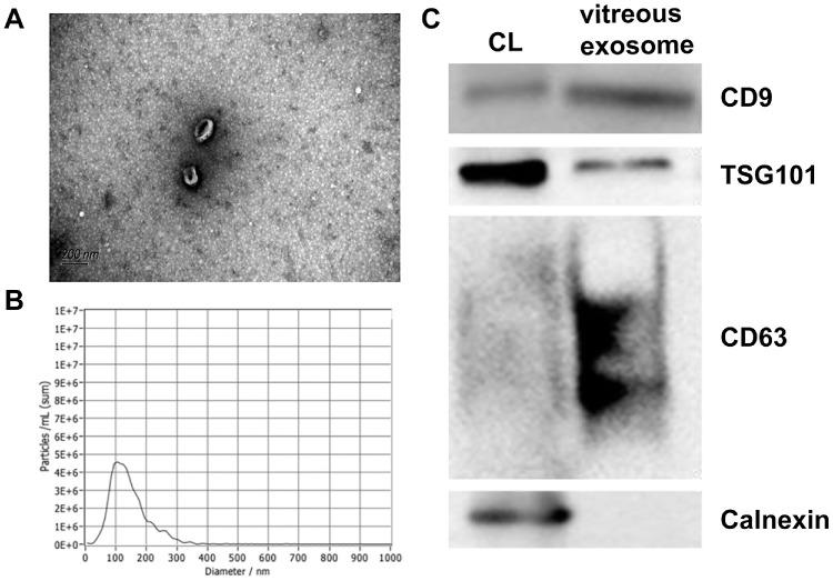 https://cdn.ncbi.nlm.nih.gov/pmc/blobs/a96d/12255188/3b92ce1d693c/iovs-66-9-24-f003.jpg