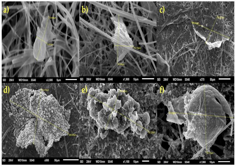 https://cdn.ncbi.nlm.nih.gov/pmc/blobs/a96f/12298248/07a1274c5b1f/toxics-13-00597-g006.jpg