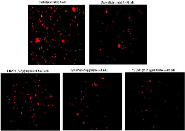 https://cdn.ncbi.nlm.nih.gov/pmc/blobs/a972/11718274/95836ff1291e/41598_2024_82376_Fig9_HTML.jpg
