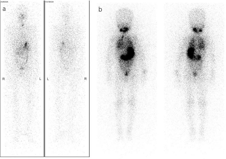 https://cdn.ncbi.nlm.nih.gov/pmc/blobs/a975/9747769/ee97b7c6d50f/fendo-13-994288-g001.jpg