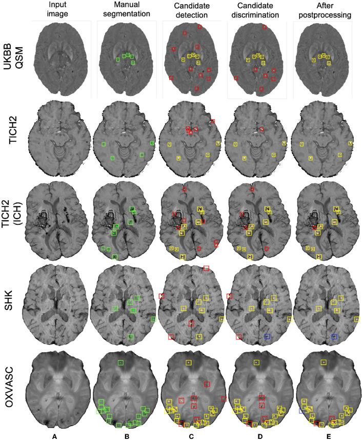 https://cdn.ncbi.nlm.nih.gov/pmc/blobs/a978/10363739/408af6150356/fninf-17-1204186-g0011.jpg