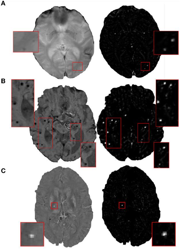 https://cdn.ncbi.nlm.nih.gov/pmc/blobs/a978/10363739/85d6f93ed031/fninf-17-1204186-g0002.jpg