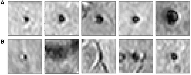 https://cdn.ncbi.nlm.nih.gov/pmc/blobs/a978/10363739/b51712fad26c/fninf-17-1204186-g0004.jpg