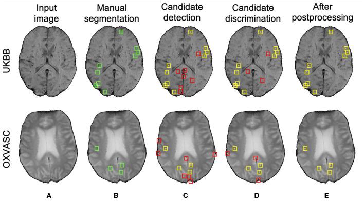 https://cdn.ncbi.nlm.nih.gov/pmc/blobs/a978/10363739/ed0ea27f10d5/fninf-17-1204186-g0010.jpg
