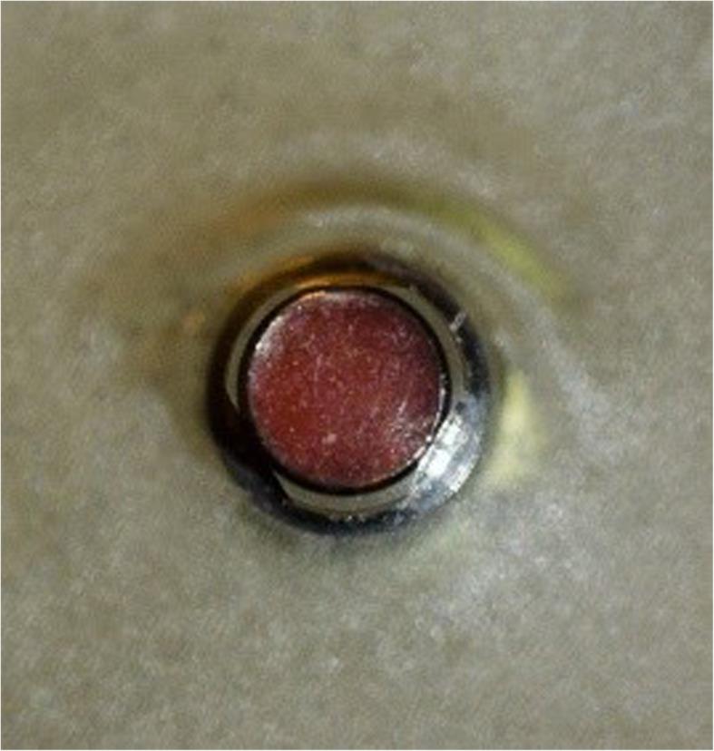 https://cdn.ncbi.nlm.nih.gov/pmc/blobs/a989/8289925/9f96e8719739/40729_2021_349_Fig2_HTML.jpg