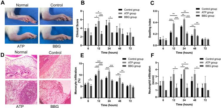https://cdn.ncbi.nlm.nih.gov/pmc/blobs/a98d/9283387/008806412270/JIR-15-1237-g0001.jpg