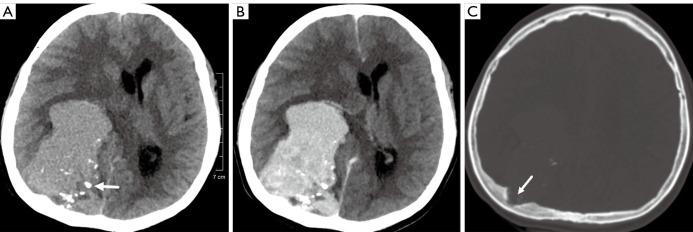 https://cdn.ncbi.nlm.nih.gov/pmc/blobs/a98d/9552257/4e1e052e754b/tcr-11-09-3409-f1.jpg
