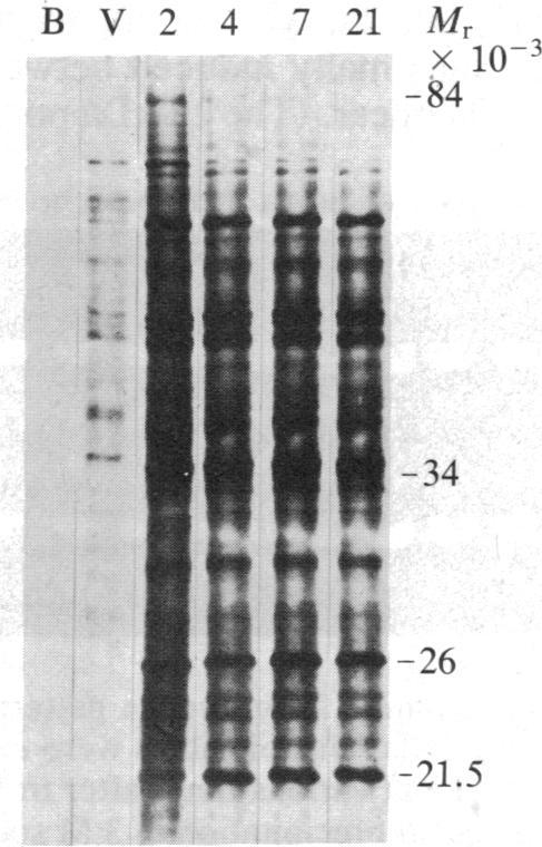 https://cdn.ncbi.nlm.nih.gov/pmc/blobs/a990/392138/fd6da3438a99/pnas00624-0065-c.jpg