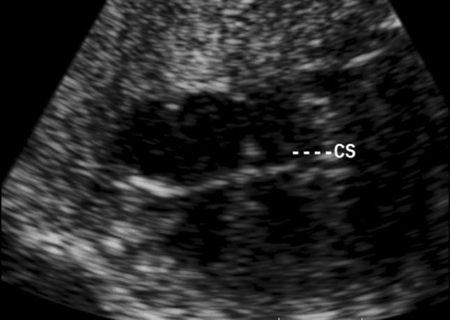 https://cdn.ncbi.nlm.nih.gov/pmc/blobs/a99a/5809570/468c456c9dea/10554_2017_1229_Fig1_HTML.jpg