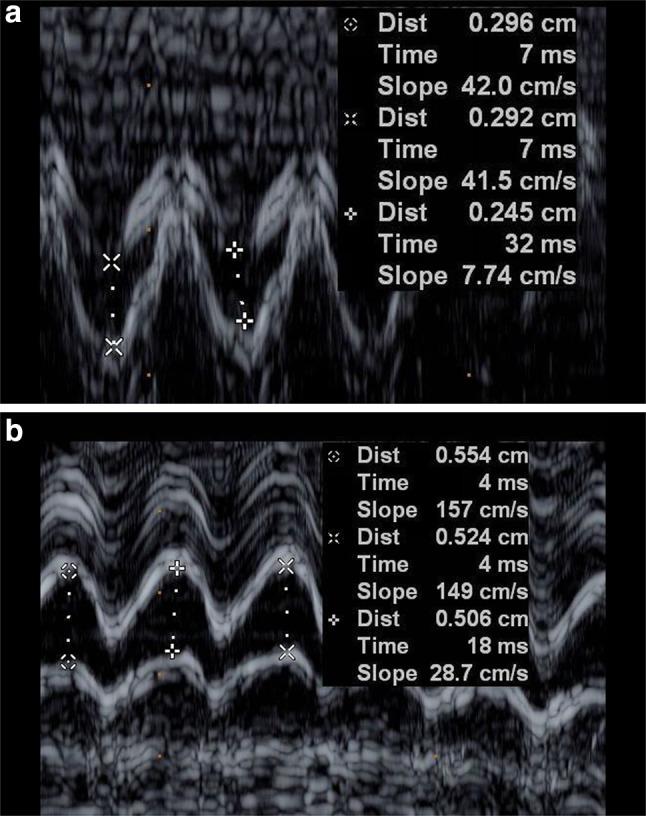 https://cdn.ncbi.nlm.nih.gov/pmc/blobs/a99a/5809570/c958e602877f/10554_2017_1229_Fig3_HTML.jpg