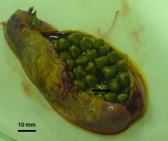 https://cdn.ncbi.nlm.nih.gov/pmc/blobs/a9a7/10543156/5bf1c54ad05e/11739_2023_3355_Fig2_HTML.jpg