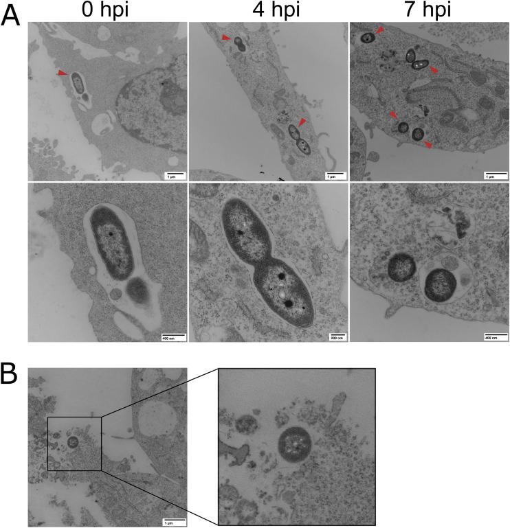 https://cdn.ncbi.nlm.nih.gov/pmc/blobs/a9a8/9430717/c5985167ab2e/spectrum.02083-22-f002.jpg