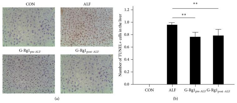 https://cdn.ncbi.nlm.nih.gov/pmc/blobs/a9aa/4241314/923656da45df/ECAM2014-538059.001.jpg