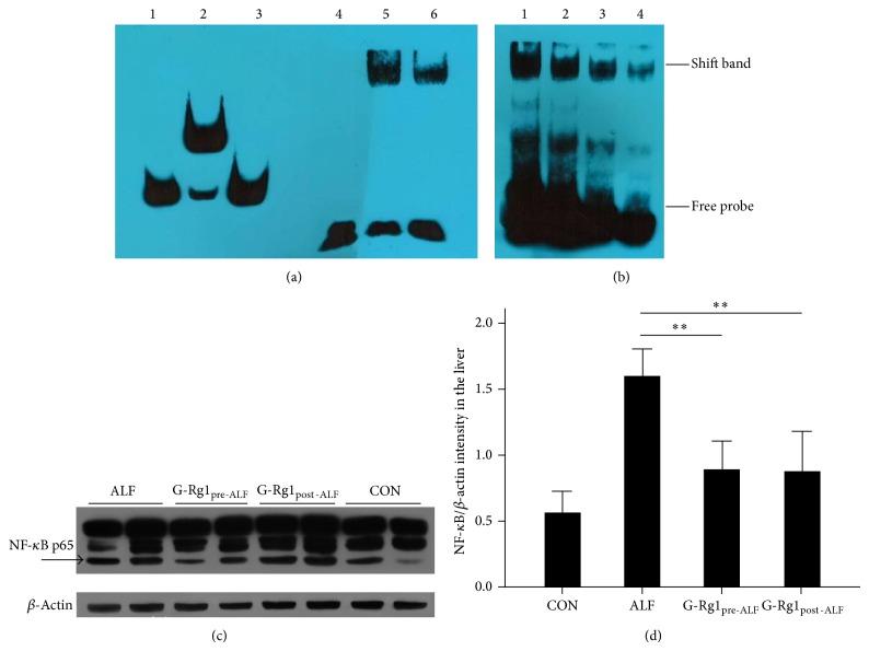https://cdn.ncbi.nlm.nih.gov/pmc/blobs/a9aa/4241314/c88740f30581/ECAM2014-538059.003.jpg