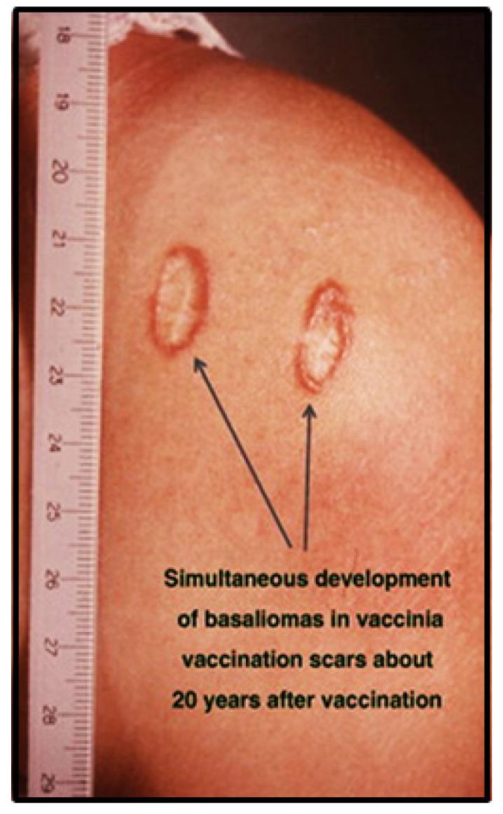 https://cdn.ncbi.nlm.nih.gov/pmc/blobs/a9aa/8582480/1b0b8e16acff/cancers-13-05407-g012.jpg