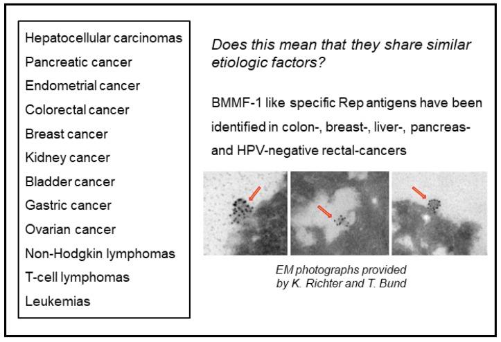 https://cdn.ncbi.nlm.nih.gov/pmc/blobs/a9aa/8582480/87ef6898c806/cancers-13-05407-g010.jpg