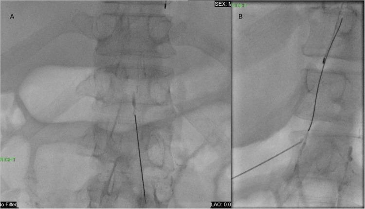 https://cdn.ncbi.nlm.nih.gov/pmc/blobs/a9ab/12185150/7f5580864178/cureus-0017-00000084754-i02.jpg