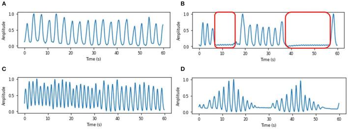 https://cdn.ncbi.nlm.nih.gov/pmc/blobs/a9b1/8959759/0b425e66e701/fphys-13-799621-g0006.jpg