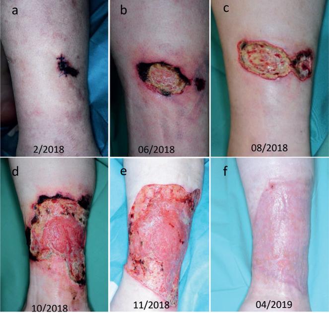 https://cdn.ncbi.nlm.nih.gov/pmc/blobs/a9b1/9367032/7df83810a784/ActaDV-101-5-697-g001.jpg