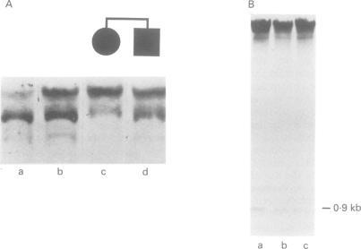 https://cdn.ncbi.nlm.nih.gov/pmc/blobs/a9b8/1016295/c26ef184dfbc/jmedgene00005-0014-a.jpg