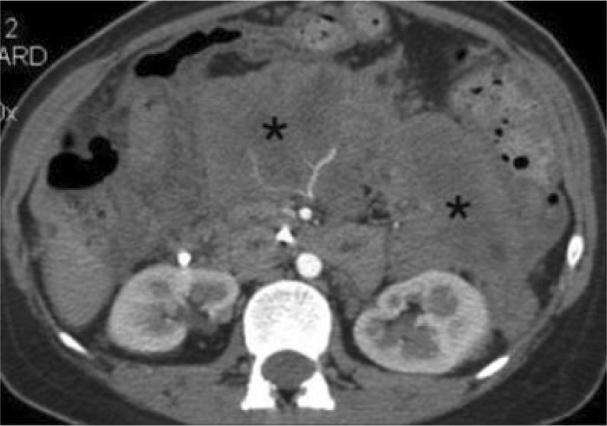 https://cdn.ncbi.nlm.nih.gov/pmc/blobs/a9b9/4896229/3bdc91d17189/gr2.jpg