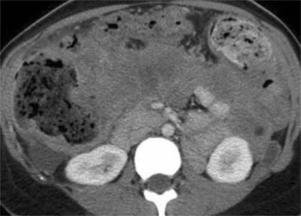 https://cdn.ncbi.nlm.nih.gov/pmc/blobs/a9b9/4896229/6965203de31d/gr5.jpg
