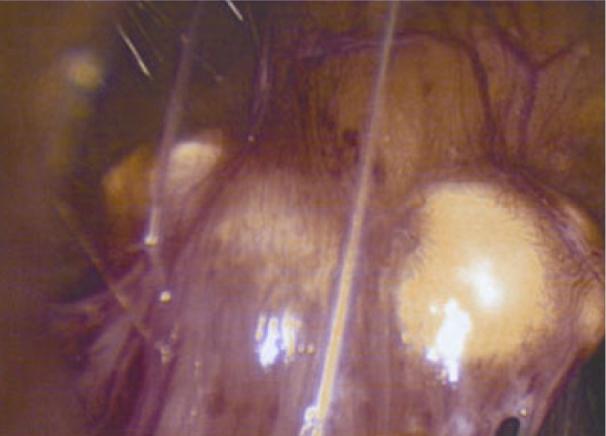 https://cdn.ncbi.nlm.nih.gov/pmc/blobs/a9b9/4896229/ebdd3cabf26f/gr4.jpg