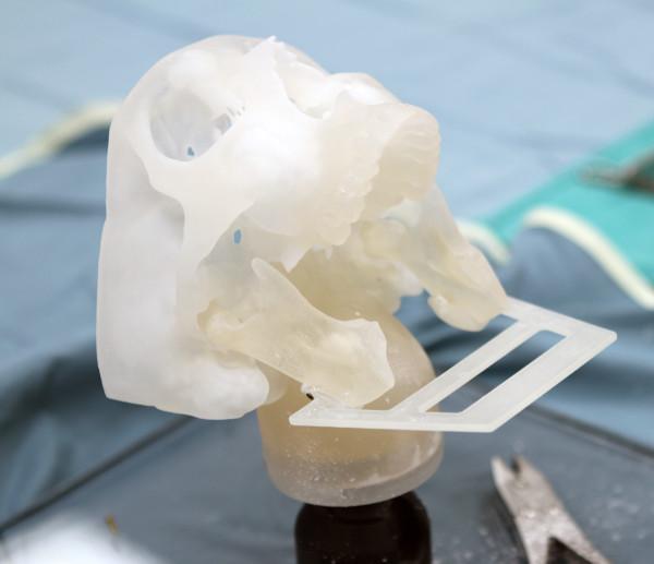 https://cdn.ncbi.nlm.nih.gov/pmc/blobs/a9ba/3729729/491e734c3020/1916-0216-42-42-6.jpg