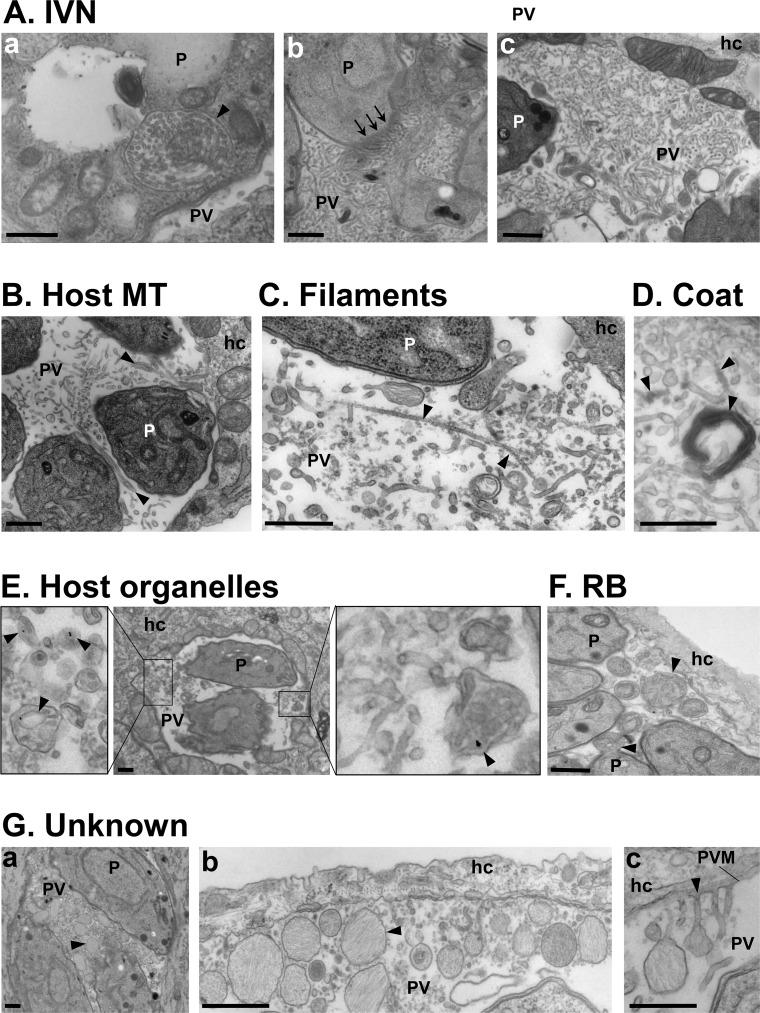 https://cdn.ncbi.nlm.nih.gov/pmc/blobs/a9bb/5875880/d4db778c0049/ppat.1006893.g001.jpg