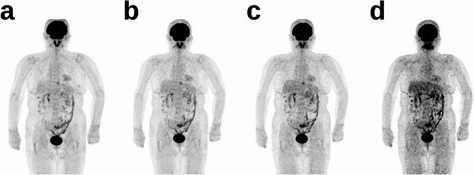 https://cdn.ncbi.nlm.nih.gov/pmc/blobs/a9bd/12325149/0f65f5123a25/13550_2025_1295_Fig2_HTML.jpg