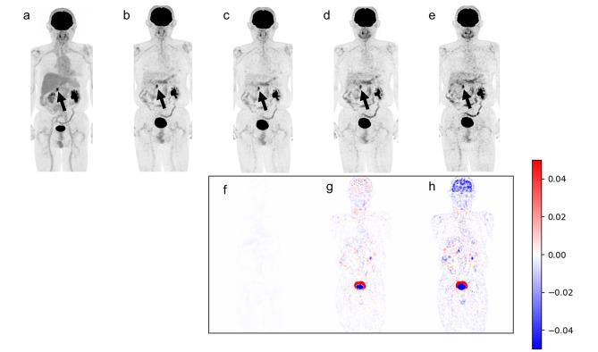 https://cdn.ncbi.nlm.nih.gov/pmc/blobs/a9bd/12325149/2e8d0cd420f0/13550_2025_1295_Fig5_HTML.jpg