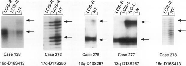 https://cdn.ncbi.nlm.nih.gov/pmc/blobs/a9c1/407928/26b6ddd2bf2a/clinmolpath00007-0023-a.jpg
