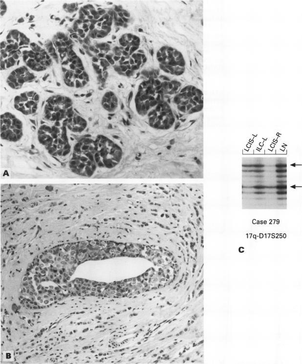 https://cdn.ncbi.nlm.nih.gov/pmc/blobs/a9c1/407928/38197bb1f2d8/clinmolpath00007-0021-a.jpg