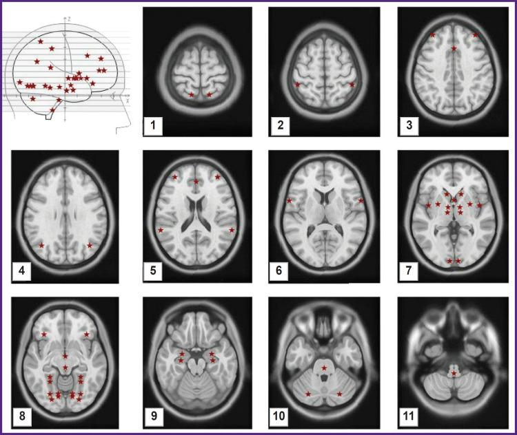 https://cdn.ncbi.nlm.nih.gov/pmc/blobs/a9c9/11780584/7c5b9f8ce3da/STM-16-6-01-f2.jpg